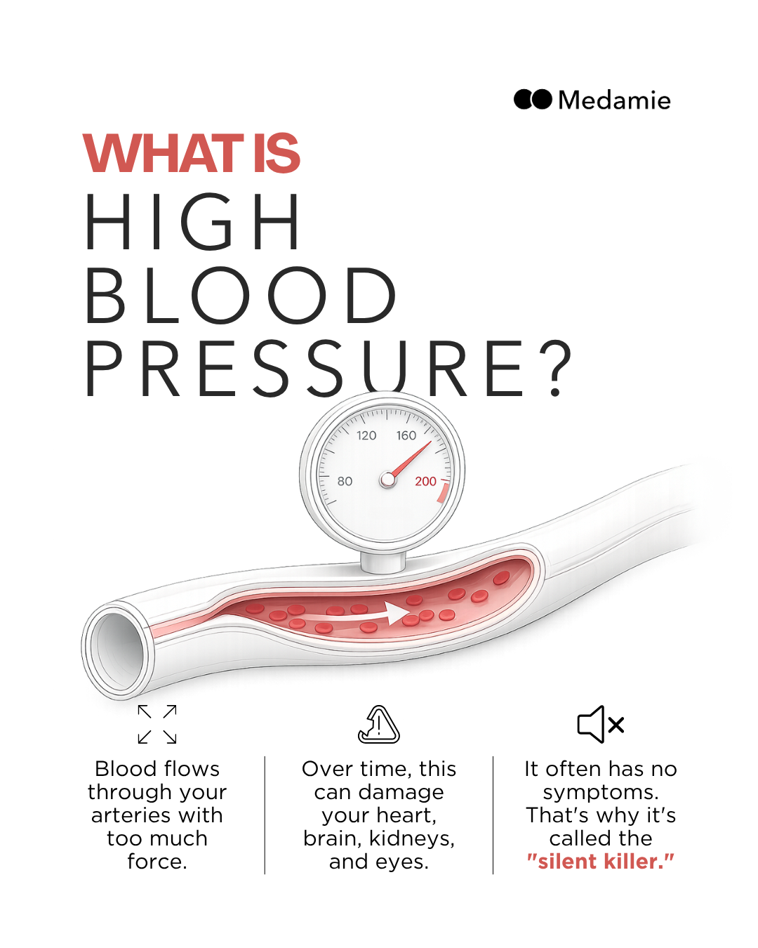 What is high blood pressure information graphic
